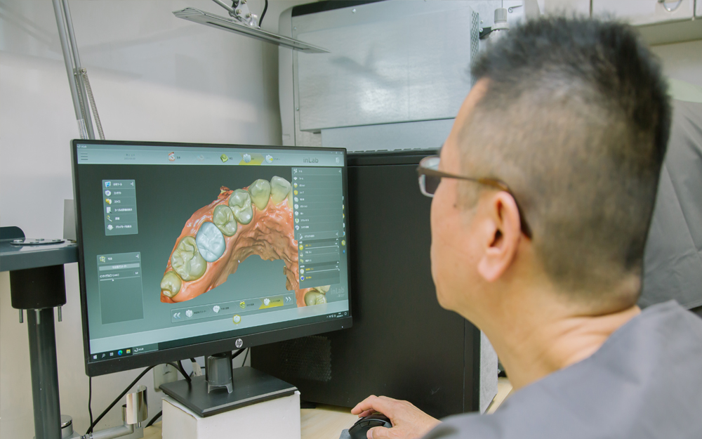 審美・咬合専門の歯科技工士との連携
