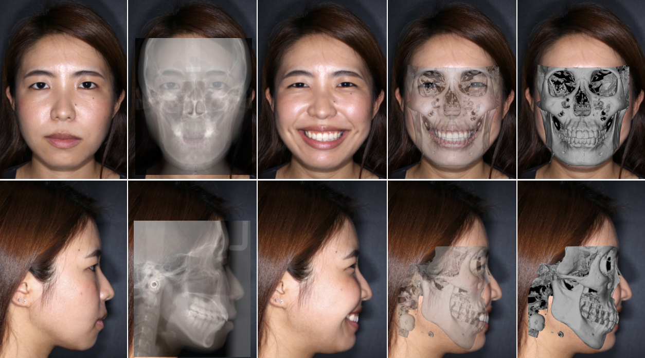 顔貌や骨格を見極めることは審美歯科においては重要な項目のひとつ