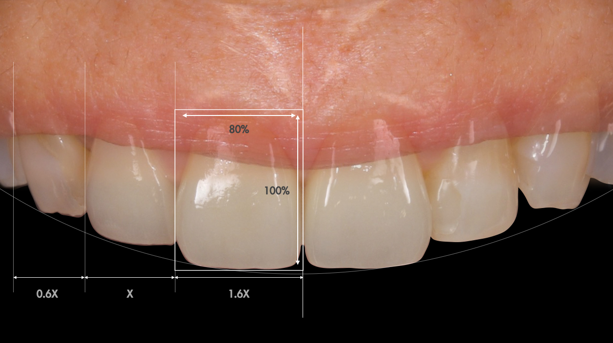 歯の並びや見え方には黄金比率が存在するが、必ずしも黄金比率にはならない